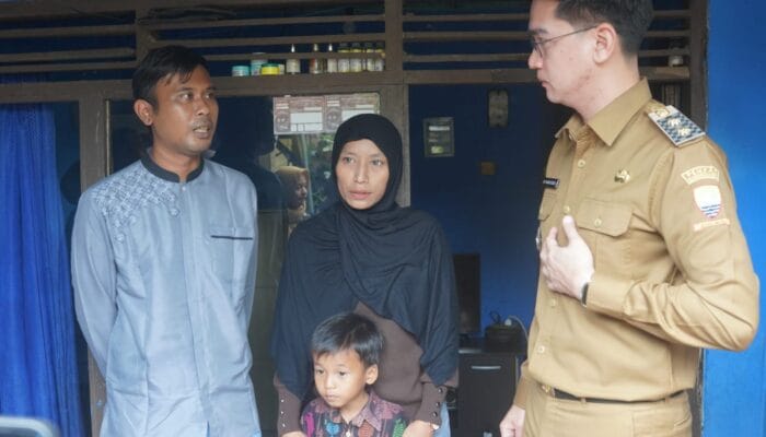 Wabup Sumedang “Jemput Bola”, Alif Siap Dioperasi Gratis!